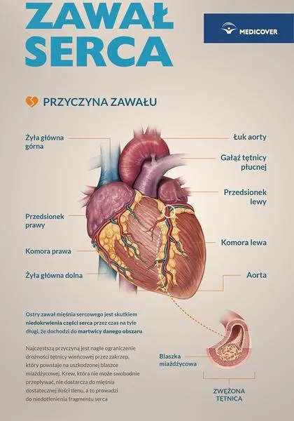 Rehabilitacja kardiologiczna